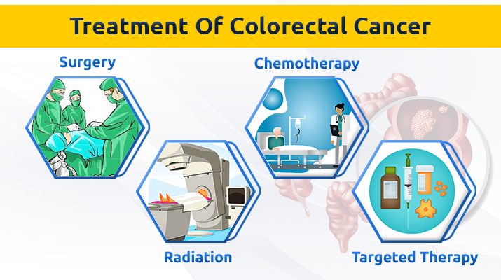 Chemotherapy for Colorectal Cancer in Pune | Dr. Sumit Shah