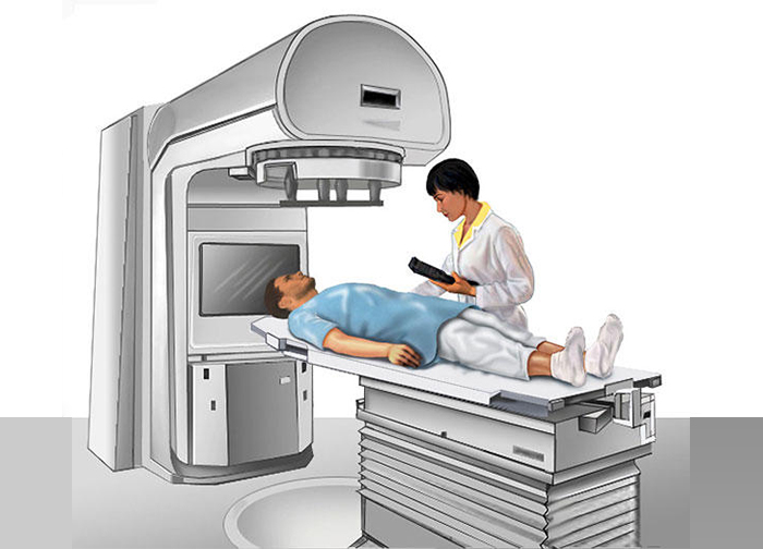 Radiation Therapy for Colorectal Cancer | Dr. Sumit Shah