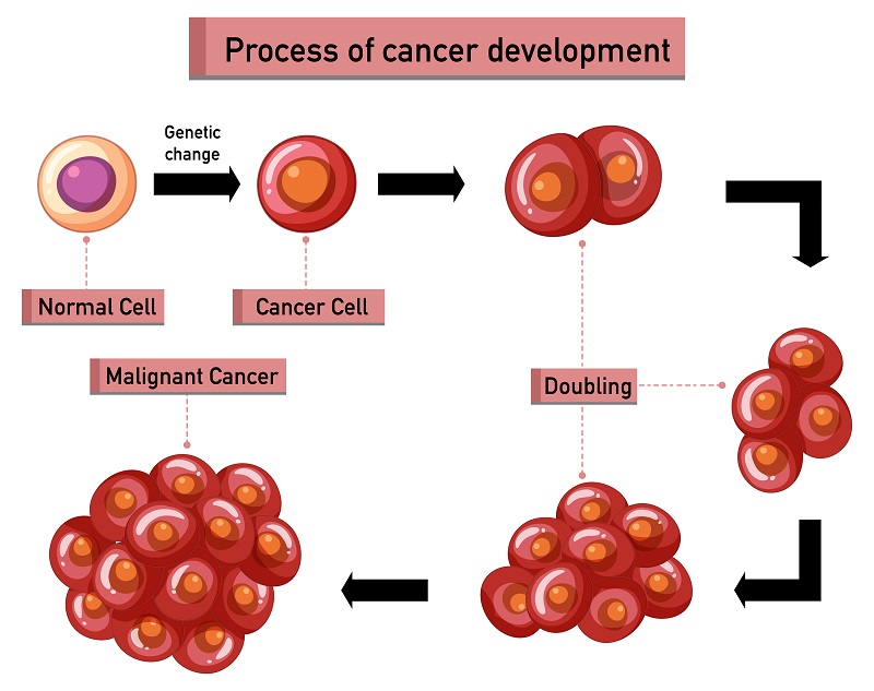 Colon Cancer Staging | Colon Cancer Treatment in Pune | Dr. Sumit Shah